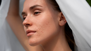 <h2>The Underserved Opportunity in Perimenopause, Menopause, and Post-Menopause Skincare</h2>